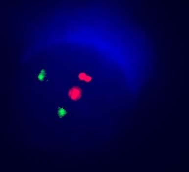 Probe (Abbott-Vysis)