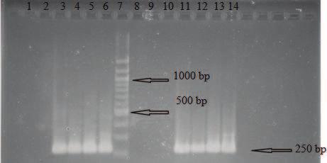 * při opakování nebyl v negativní kontrole produkt PCR detekován + PCR produkt byl detegován, - PCR produkt nebyl detegován Produkt PCR o velikosti 466 bp specifický pro doménu Bacteria byl detekován