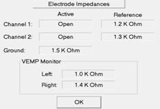 Obrázek 16: Impedanční test elektrod Hodnoty impedančního testu elektrod by měly být maximálně do 5kΩ a rozdíly mezi jednotlivými hodnotami impedancí by neměly přesahovat 2kΩ.