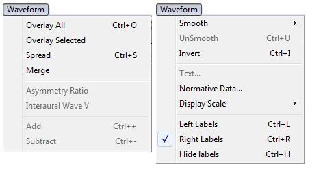 Waveform Obrázek 26: Waveform Rozbalování tohoto okna se používá při měření nejvíce, z důvodu práce s křivkou při měření.