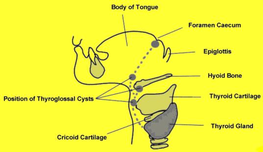 htm~right http://www.learningradiology.