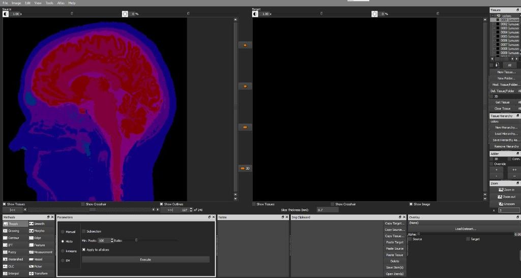 přívětivý program. Tento program z hlavičky snímků ve formátu DICOM vnese do obrazu informaci o rozměrech daného pixelu. Dále z uvedené šířky tomografické roviny zanese do obrazu objemovou informaci.