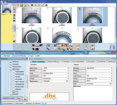 Info Systémy pro vyhodnocení obrazu Systém správy obrázků profesionální, modulární, dle norem - pro rozsáhlé úkoly v rámci kontroly kvality Databáze obrázků dhs se používá především v oblasti