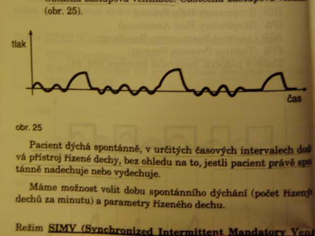 Asynchronní ventilační režimy dechový cyklus ventilátoru je zahájen bez ohledu na fázi dechového