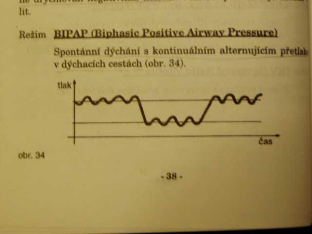 BiPAP (biphasic positive airway pressure) spontánní dýchání na dvou úrovních přetlaku v