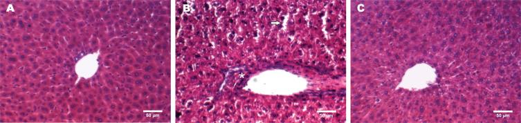 Obrázek 2 Histologické barvení jaterních buněk, světelný mikroskop [27] Aspartam též snížil hodnoty GSH o 30 %, po podávání N-acetylcysteinu se hodnoty GSH vrátily do normálu.