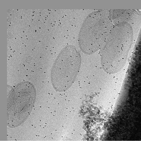 Kryogenní elektronová tomografie granální