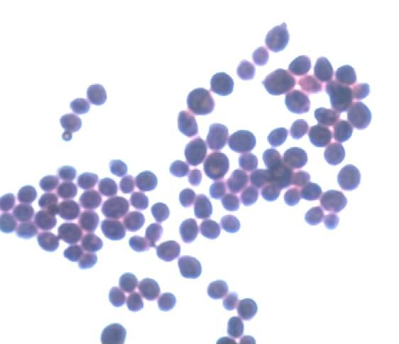 Mikroorganismy pasterované smetany Mikroorganismy pasterované smetany: koliformní bakterie (hygiena provozu) proteolytické MO (hořká chuť rozklad bílkovin na peptony a peptidy) psychrotrofní MO (rod