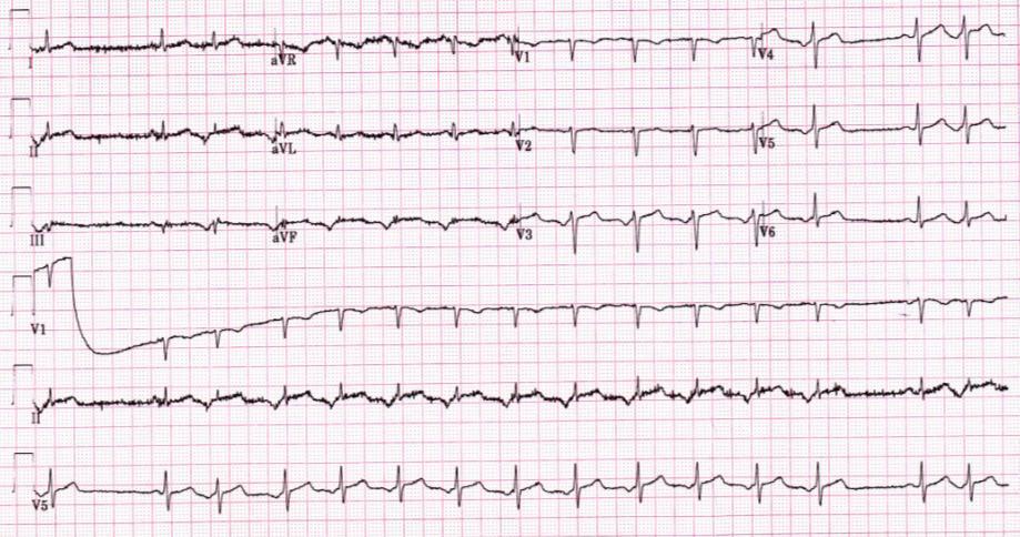 EKG 7A