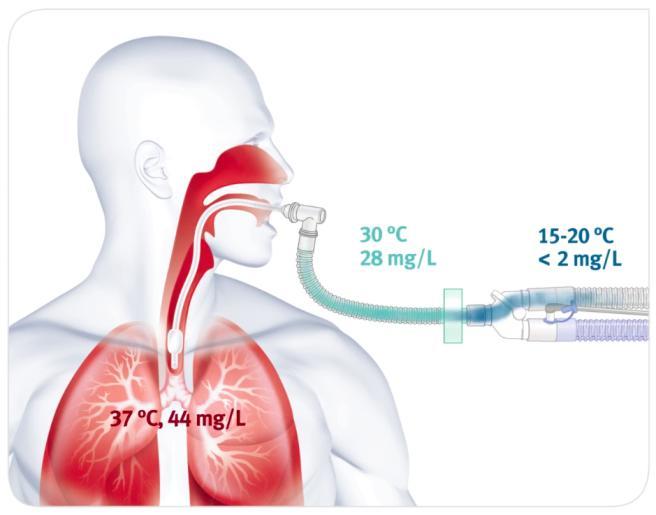 Výměník tepla a vlhkosti (HME) Dosahuje teploty 25 30 o C a absolutní vlhkosti 17 32 mg/l. Mrtvý prostor Dospělý HME filtr přidává 50-100 ml. Pro vyrovnání se musí zvýšit dechový objem.