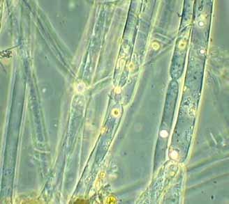 Sladkovodní houby Oomycota - saprotrofové i parazité (Aphanomyces astaci) saprotrof např.