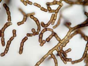 compniacensis