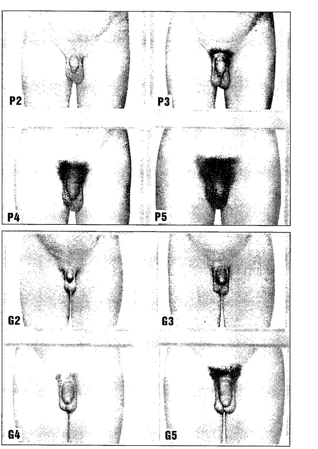 Reprodukční systém chlapců: Růst a maturace testes, penisu a přídatných pohlavních orgánů a rozvoj pubického