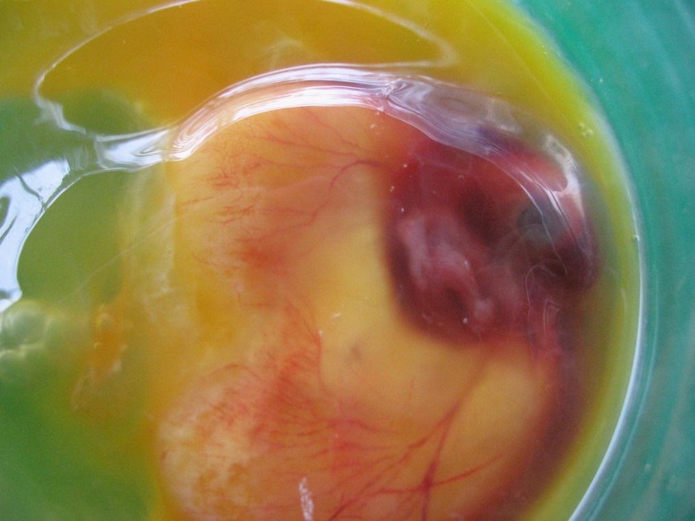 12. U tohoto embrya zřetelný krevní
