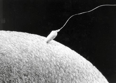Neplodnost Zralá mužská pohlavní buňka, spermie, je dlouhá až 70 µm.