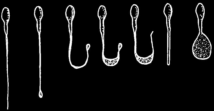 spermií, otoky čepiček hlaviček a zdvojení hlaviček nebo bičíků.