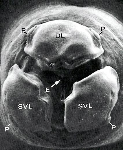 Ascaris lumbricoides