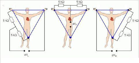 levé nohy. kde avr, avl a avf značí napětí na augmentovaných svodech pravé ruky, levé ruky a RA LA RA LA RA LA LL LL LL Obrázek 2.