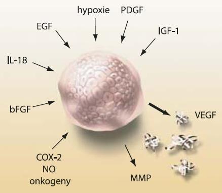 Při nádorové angiogenezi, kterou nejčastěji vyvolá hypoxie či zánět v nádorových buňkách, dochází k tzv.