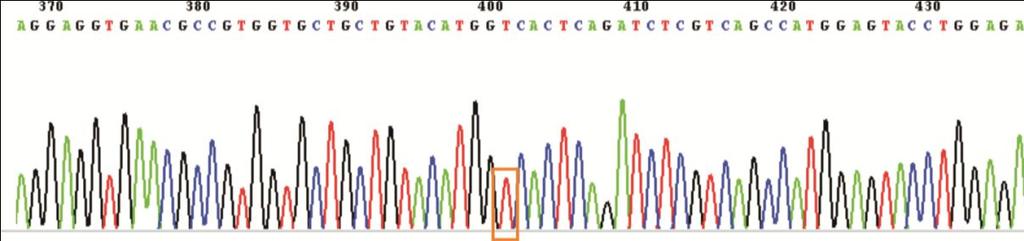 K detekci mutací v ABL kinázové doméně se vyuţívá techniky dvoukolové nested PCR. Výsledný PCR produkt je přímo sekvenován na kapilárním sekvenátoru ABI3130.