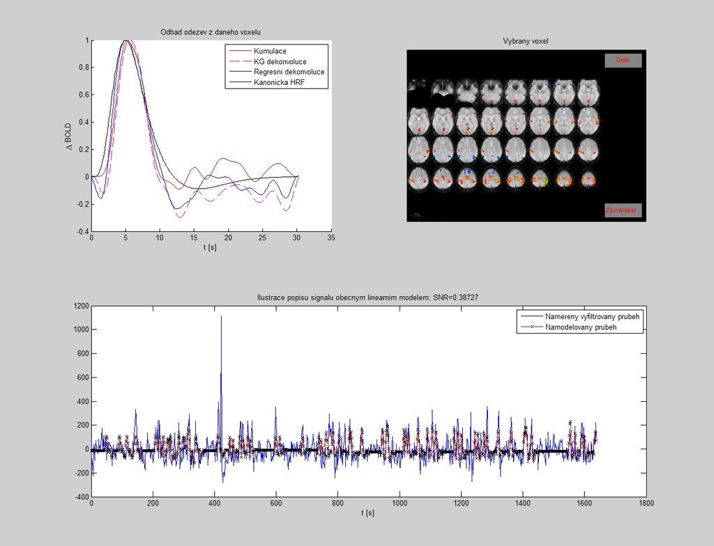HRF; uvedena je zde taky v popisu tohoto dílčího okna hodnota SNR pro daný voxel; Při výběru z clusteru jsou v jednotlivých dílčích oknech vykresleny: - tři průběhy odhadů HRF, které jsou