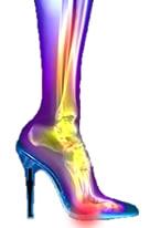4-22 Příčně plochá noha Nevhodné nošení obuvi vede k tomu, že u žen převládá a je nejčastější výskyt nohy příčně ploché.