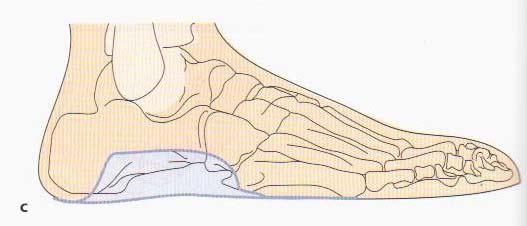 Třetí záhyb je na zevním okraji nohy proti krychlové kosti /nesmí být distálněji/!