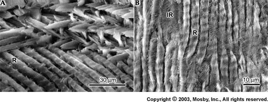 Mikroskopická stavba skládá se ze sklovinných hranolů prizmat, oddělených asi 1 µm širokými proužky