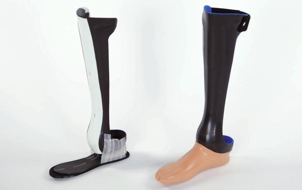 1 Úvod Tyto technické informace vám poskytnou podporu jako ortotikovi-protetikovi pri výrobě protézy Chopart.