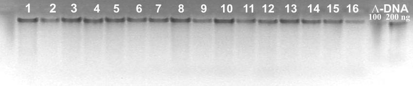 5. VÝSLEDKY 5.1 IZOLACE DNA, KONTROLA ČISTOTY A KONCENTRACE Pro stanovení kvality izolované DNA, byla použita kontrolní elektroforéza na 0,8% agarózovém gelu (kapitola 4.4.3.