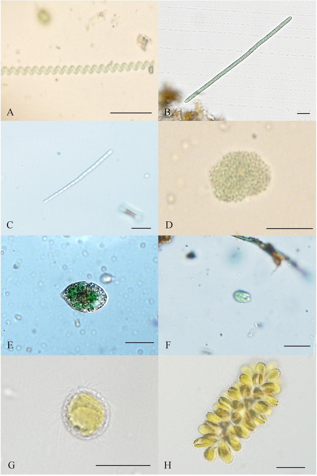 Příloha 10: Fotodokumentace vybraných zástupců Cyanophyceae (A Arthospira sp., B Phormidium autumnale, C Pseudanabaena sp., D Woronichinia sp.