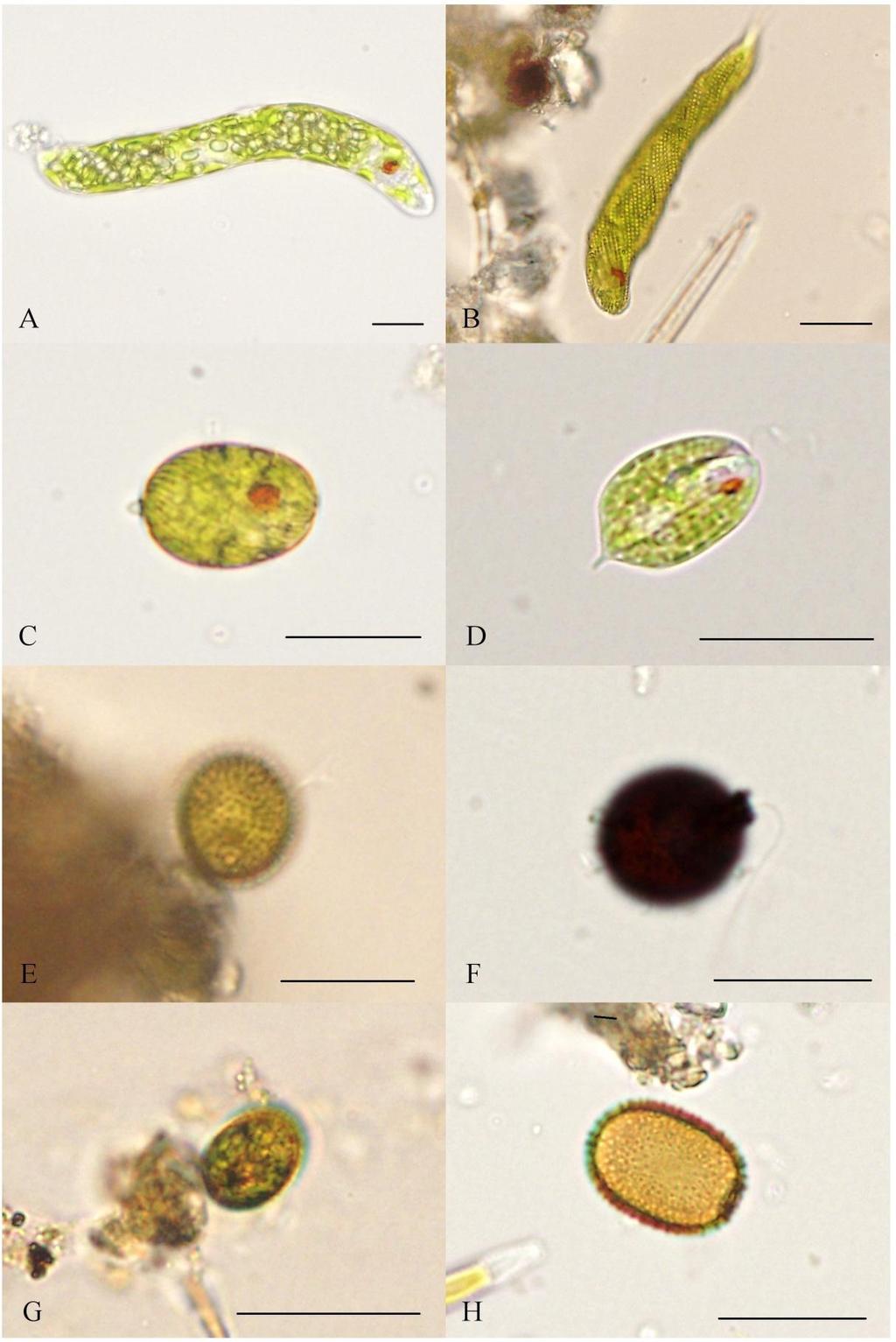 Příloha 11: Fotodokumentace vybraných zástupců Euglenophyceae (A Euglena gracilis, B Euglena spirogyra, C Lepocinclis ovum var.