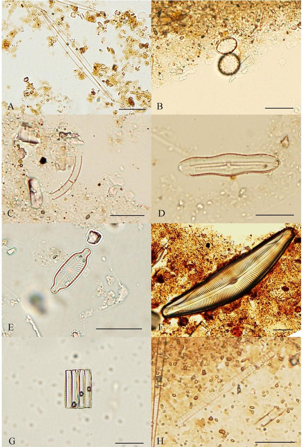 Příloha 12: Fotodokumentace vybraných zástupců Bacillariophyceae I (A Amphipleura pellucida, B Aulacoseira distans, C Aulacoseira