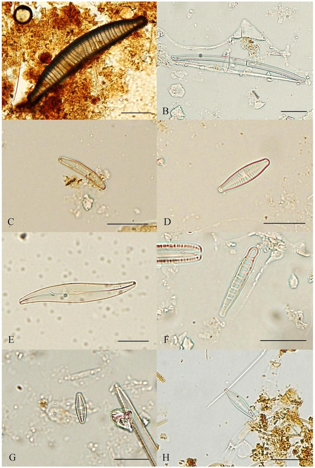 Příloha 13: Fotodokumentace vybraných zástupců Bacillariophyceae II (A Epithemia argus, B Eunotia parallela, C Eunotia pectinalis, D