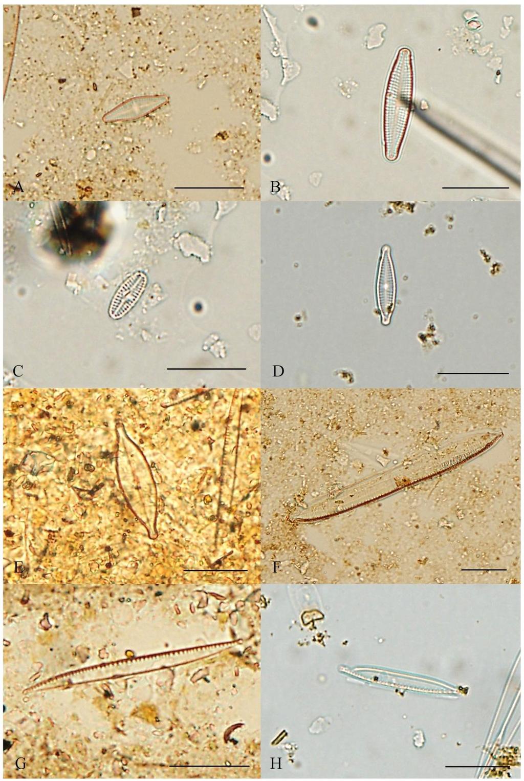 Příloha 14: Fotodokumentace vybraných zástupců Bacillariophyceae III (A Navicula goeppertiana, B Navicula laterostrata, C Navicula