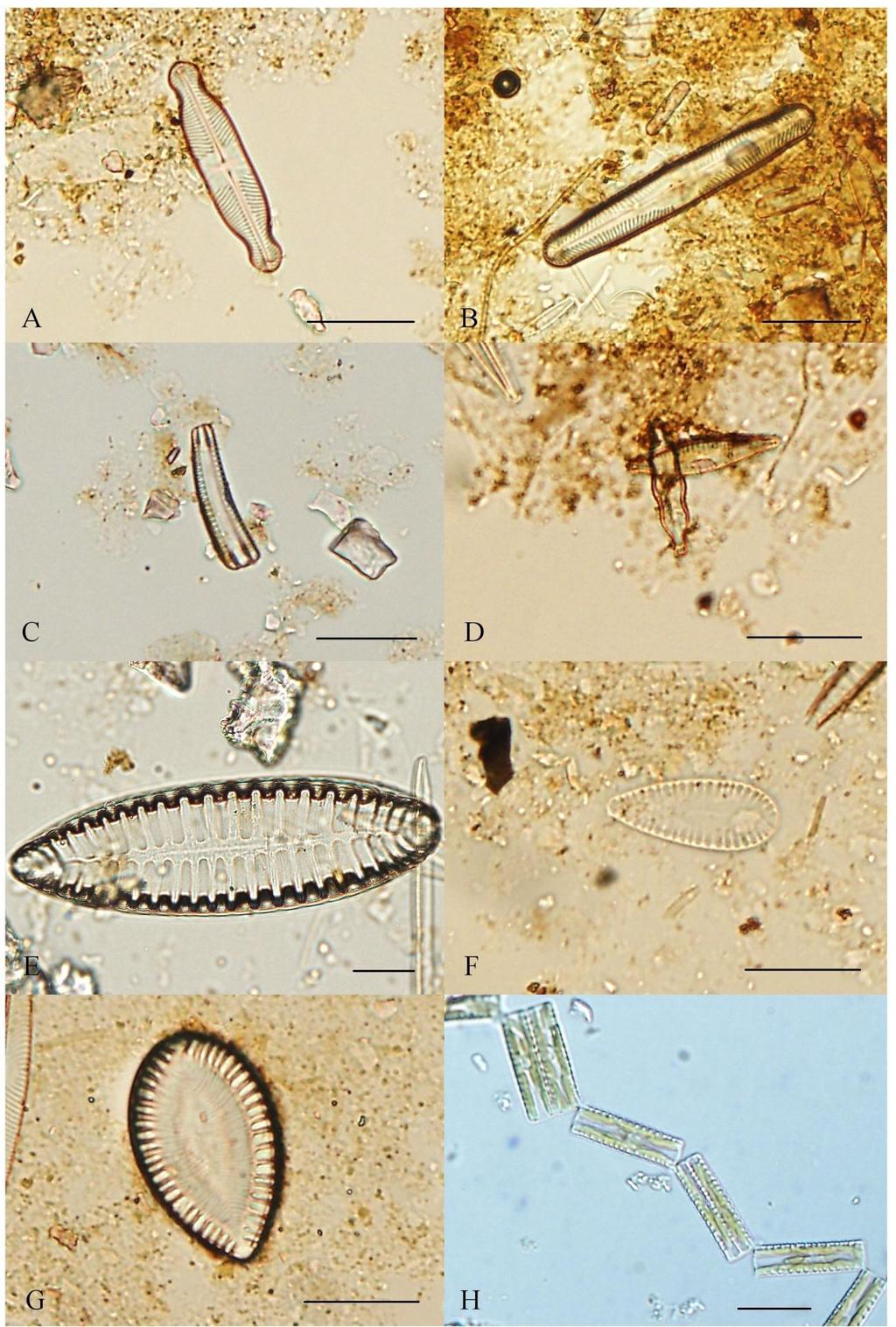 Příloha 15: Fotodokumentace vybraných zástupců Bacillariophyceae IV (A Pinnularia lundii, B Pinnularia stomatophora, C Rhoicosphenia