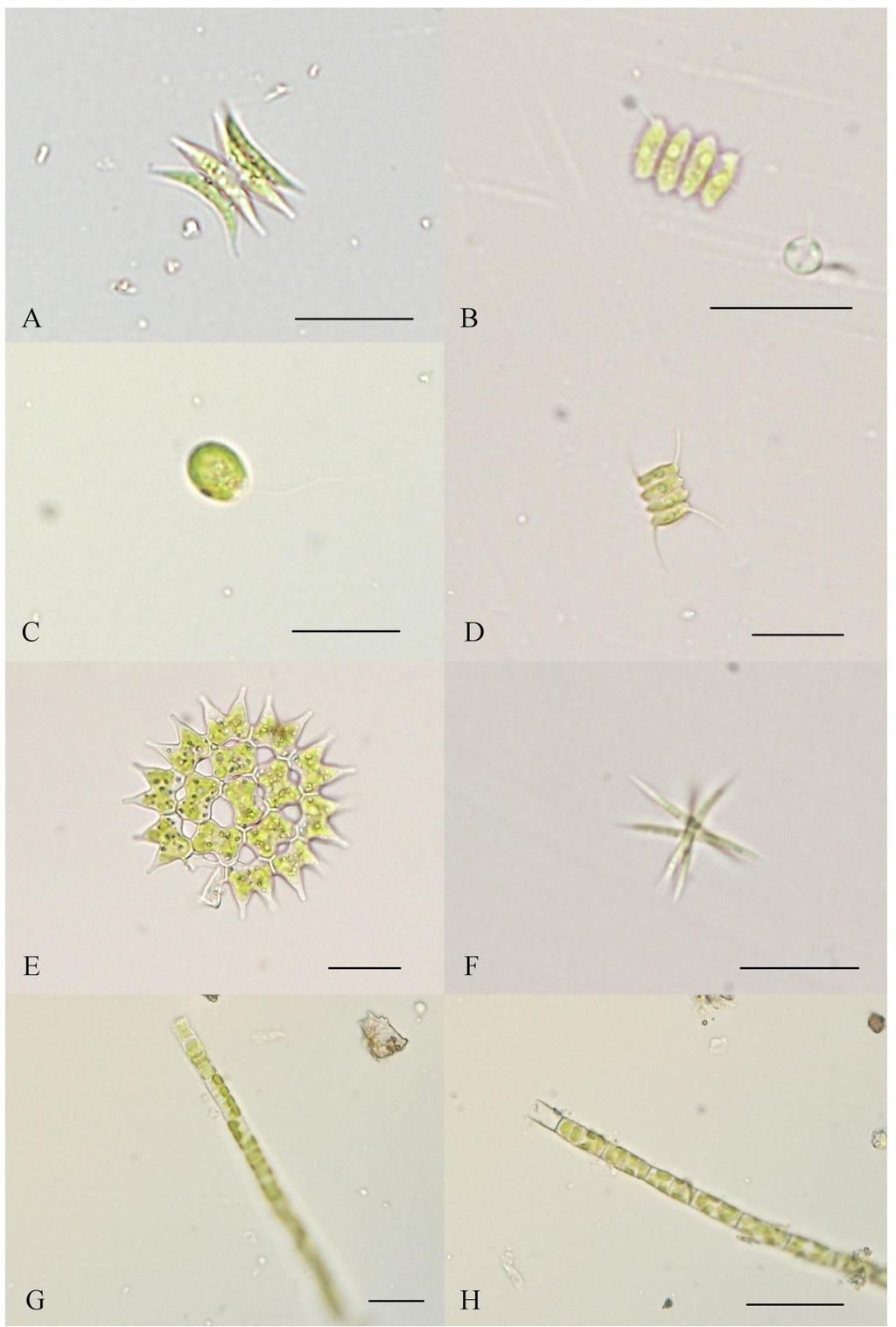Příloha 16: Fotodokumentace vybraných zástupců Chlorophyceae (A Acutodesmus acuminatus, B Acutodesmus sooi, C Carteria sp.