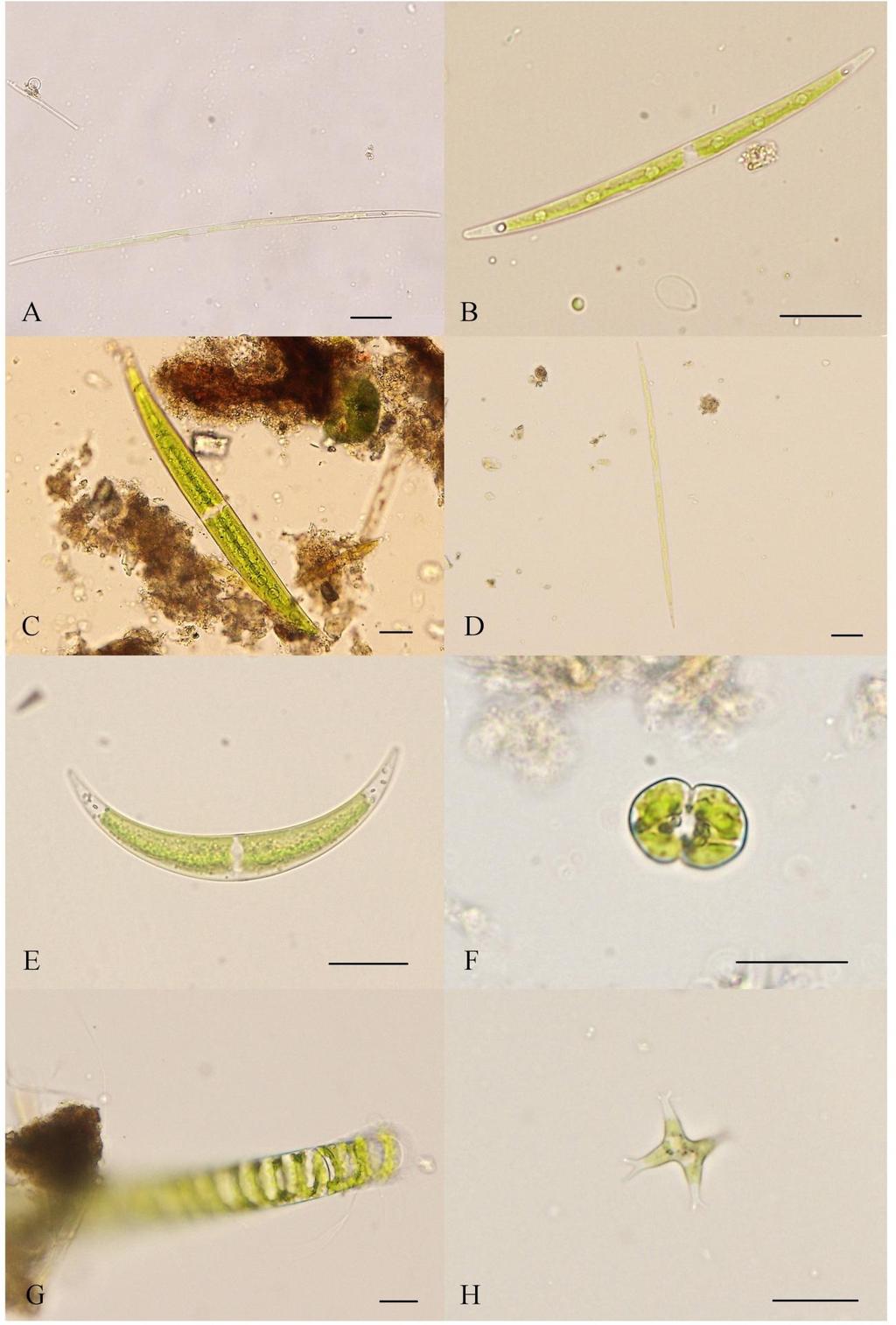 Příloha 17: Fotodokumentace vybraných zástupců Zygnematophyceae (A Closterium gracile var.