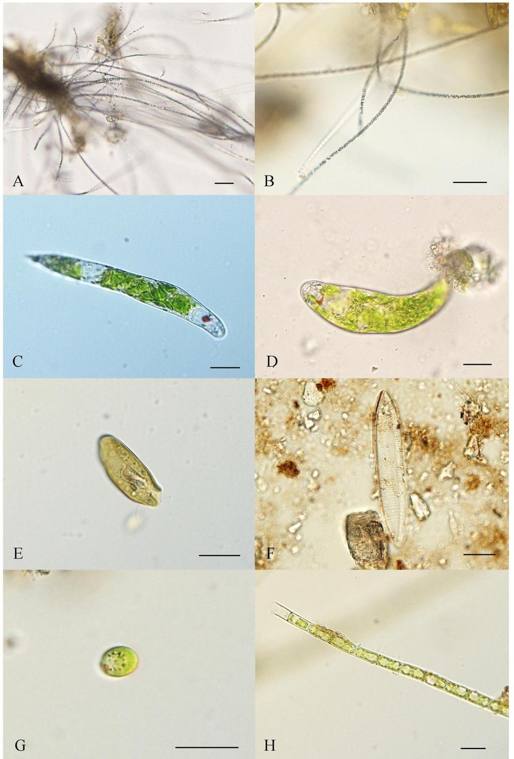 Příloha 18: Problematické druhy (A, B neznámá sinice, C Euglena cf. deses, D Euglena sp.
