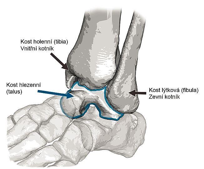 Calcaneus, kost patní, je pro náš rozbor nejdůležitější kost. Je to největší a zároveň i nejmasivnější kost z celého souboru ossa pedis.