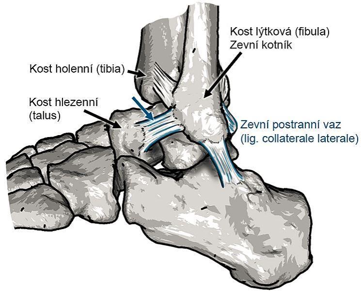 Prvním skloubením je articulatio talocruralis (horní kloub zánártní) neboli hlezenní kloub. Jedná se o spojení vidlice bércových kostí, dolní část kosti holenní a lýtkové s kostí hlezenní.