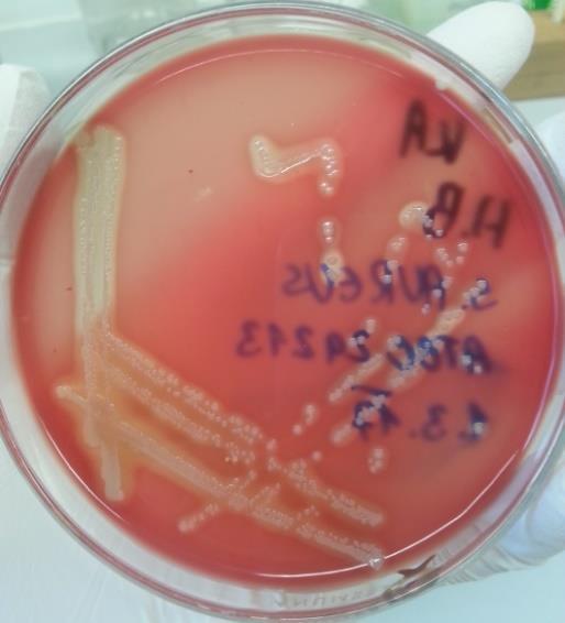 Příloha č. 3: Nárůst Staphylococcus aureus na KA Příloha č.