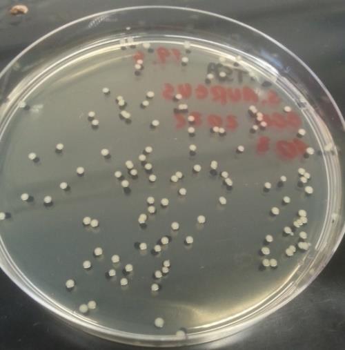 5: Kolonie bakterie Staphylococcus aureus na TSA agaru po