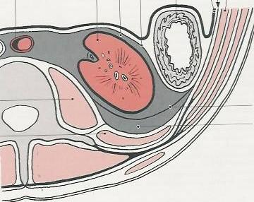 Obaly a fixace ledvin CA CF CAP FR OBALY Capsula fibrosa Capsula adiposa Fascia renalis 2 listy: kaudálně odděleny