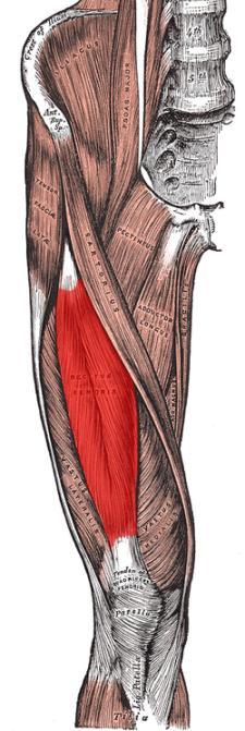 Obr.1: priamy sval stehna Obr.2: napínač širokej pokrývky Obr.