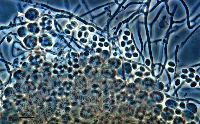 Ascomycota- Byssochlamys Shluk vřecek s askosporami na myceliu Vyskytuje se často především na kazících se potravinách nedostatečně tepelně ošetřených (mošty, ovocné dřeně,