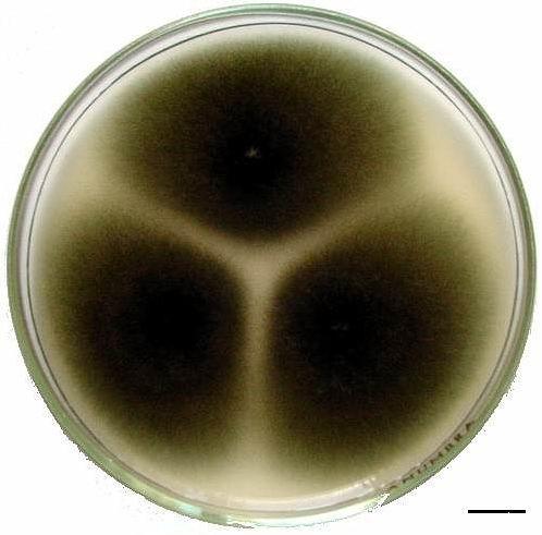 Deuteromycetes - Alternaria Vyskytuje se velmi hojně na celém světě, a to na různých substrátech rostlinného původu včetně potravin a krmiv a také v půdě Může produkovat vysoce toxický