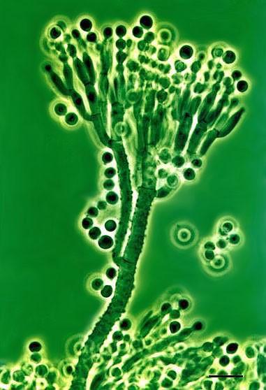 Deuteromycetes - Penicillium Penicillium requeforti Používá se pro výrobu sýrů typu Roquefort Může se vyskytnout i jako kontaminanta jiných potravin či krmiv