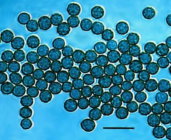 Deuteromycetes - Trichoderma Hojně rozšířená půdní houba vyskytující se též na dřevě, uskladněných obilninách, ovoci a zelenině