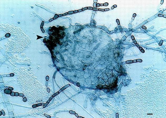 Deuteromycetes - Phoma